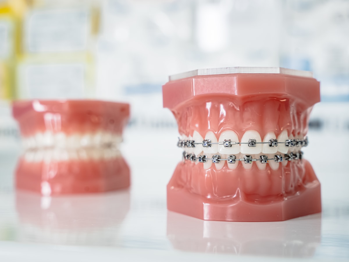 Vì sao vệ sinh miệng khác biệt khi niềng răng