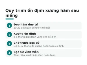 Quy trình ổn định xương hàm sau niềng