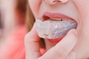 Hàm trainer cho bé có tốt không? Ưu điểm và hạn chế