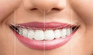 Tập mewing có sửa được sai khớp cắn không? Hiệu quả và lưu ý
