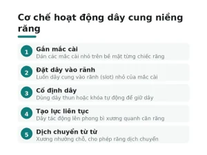 Cơ chế hoạt động dây cung niềng răng