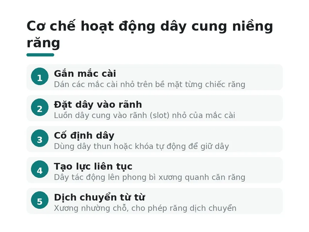 Cơ chế hoạt động dây cung niềng răng