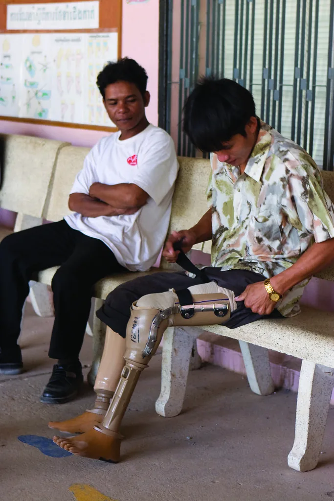 Tại sao phải tái khám định kỳ khi niềng răng?