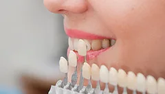 Yếu tố nào ảnh hưởng đến giá bọc sứ?