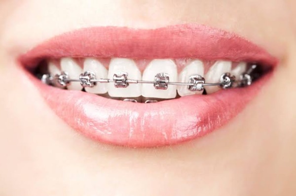 Khoảng thời gian thấy thay đổi khuôn mặt