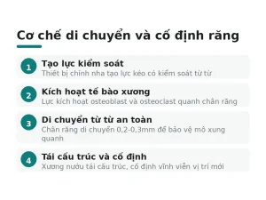Cơ chế di chuyển và cố định răng