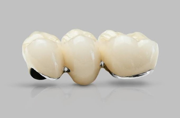 Tại sao trà, cà phê khiến bọc sứ ố vàng?