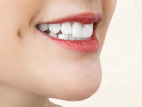 Bọc răng sứ có hôn được không? Câu trả lời từ nha sĩ