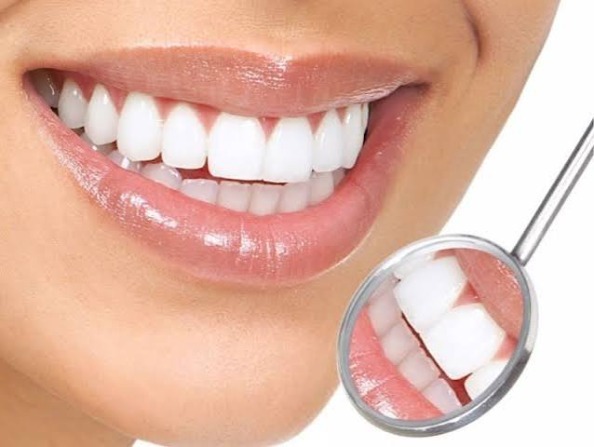 Bọc răng sứ: Định nghĩa, chỉ định và loại phù hợp